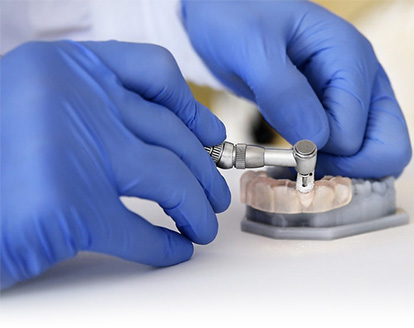 Surgical Guides for Dental Implants