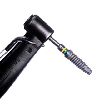 Titanium Dental Implant