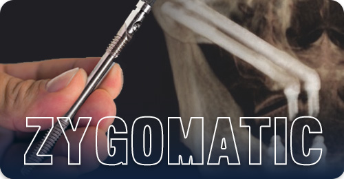 Zygomatic dental implants