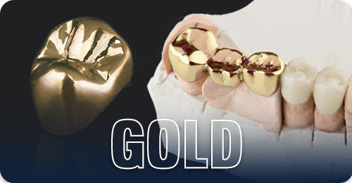 Types of crowns - Gold crowns