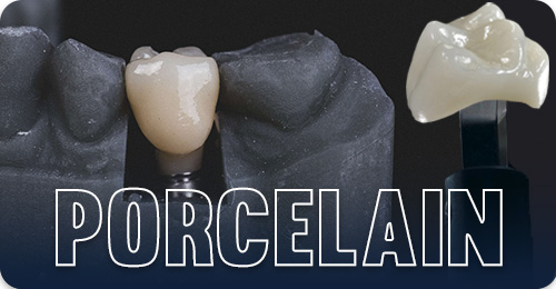 Types of crowns - Porcelain crowns