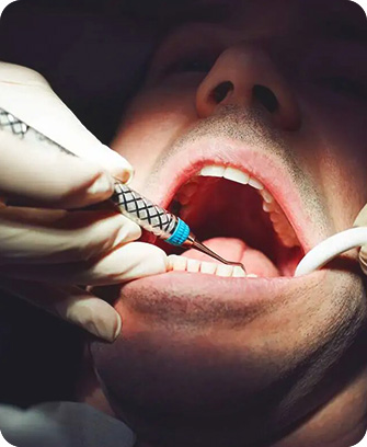 Tooth evaluation dental crowns process - Step 1