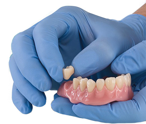 Acrylic Denture