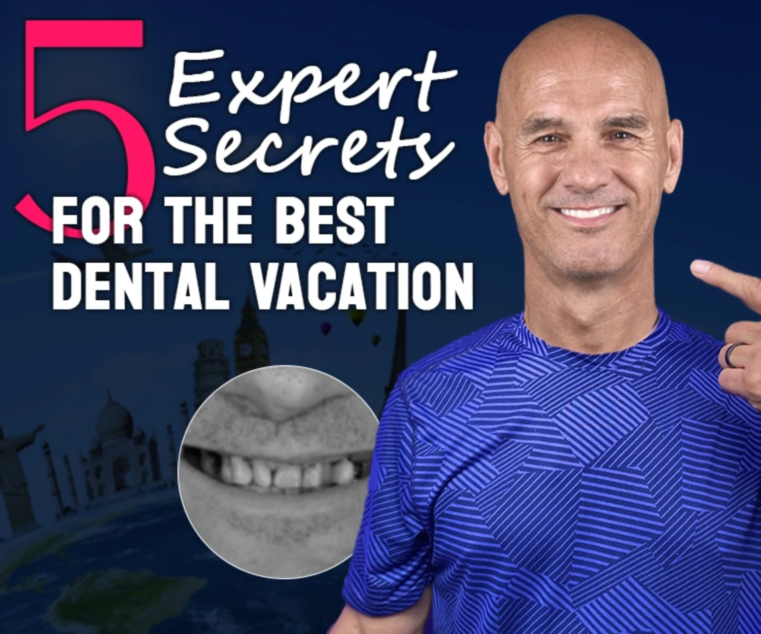 Expert tips for the best Overseas Dental Holidays