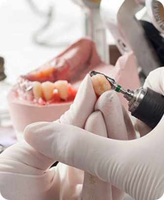 Process of getting dentures - Step 3