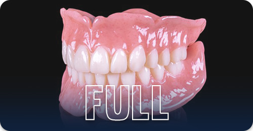 Full dentures- Types of denture