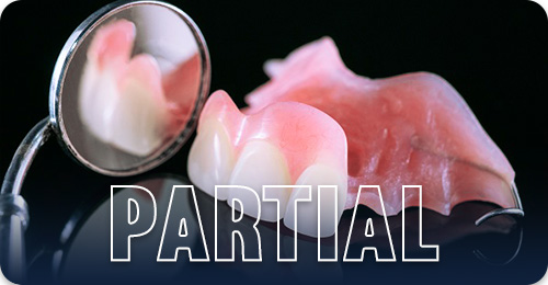 Partial denture - Types of denture
