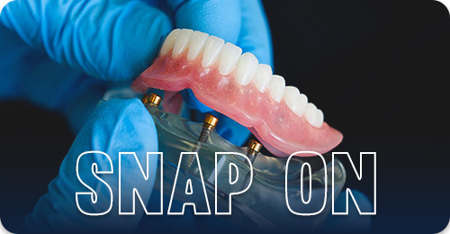 Snap on denture- Types of dentures