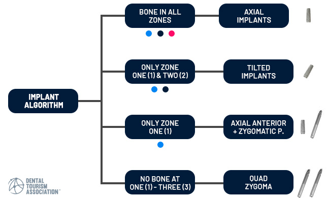 Implant Algorithm Infographics