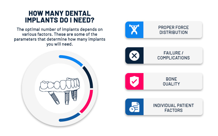 How many implants do I need? Factor Infographics