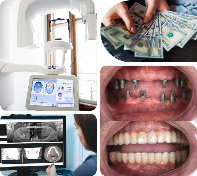 Surgical Phase Dental Implants