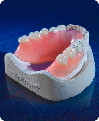 Temporaries - Surgical Phase Dental Implants Process