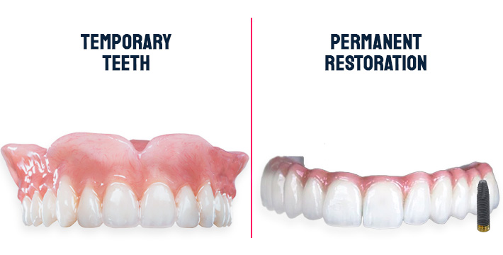 Differences between temporary teeth vs permanent restoration