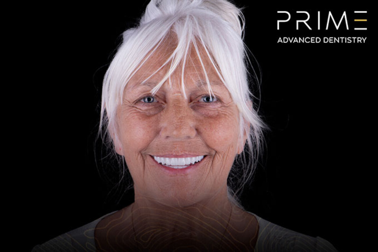 Prime Advanced Dentistry, real patient 4