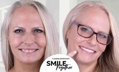 Smile Together Tijuana, Best Dentist in Tijuana
