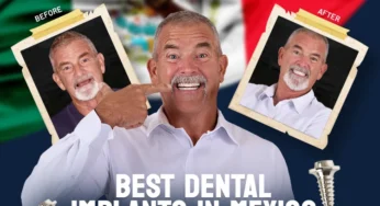 Best Dental Implants in Mexico: Top Rated 2026