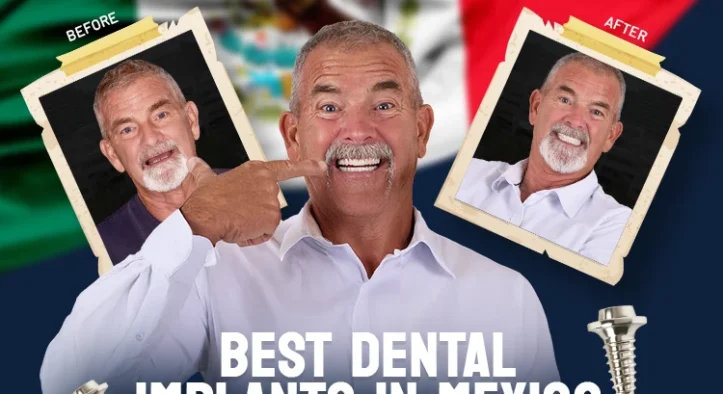 Best Dental Implants in Mexico: Top Rated 2026